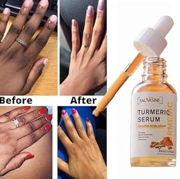 🔥suero corrector de manchas oscuras🥰🔥🔥