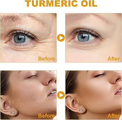 🔥suero corrector de manchas oscuras🥰🔥🔥