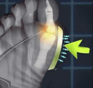 🔥💫MOCASINES ORTOPEDICO Y SUELA ANTIDESLIZANTE🎊🤩