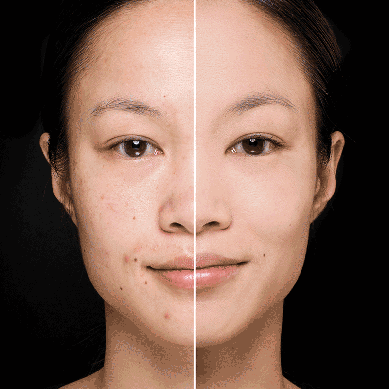 👉🤩BASE PHOERA MATTE ALTA COBERTURA💫🔥