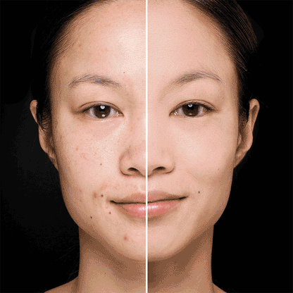 👉🤩BASE PHOERA MATTE ALTA COBERTURA💫🔥