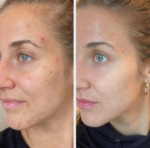 🔥suero corrector de manchas oscuras🥰🔥🔥