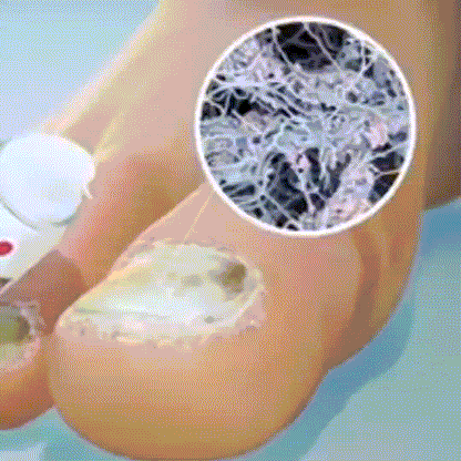 💅FUNGI BYE SPRAY🍃