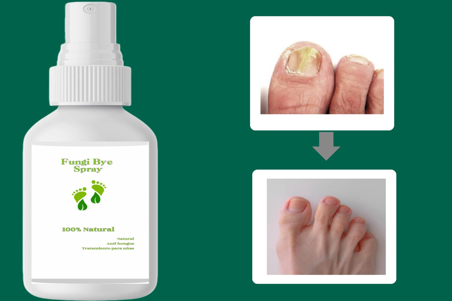 💅FUNGI BYE SPRAY🍃