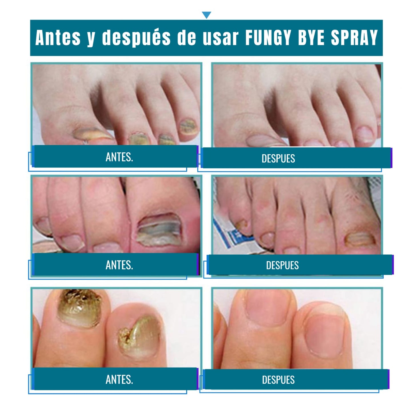 💅FUNGI BYE SPRAY🍃