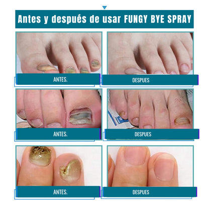 💅FUNGI BYE SPRAY🍃