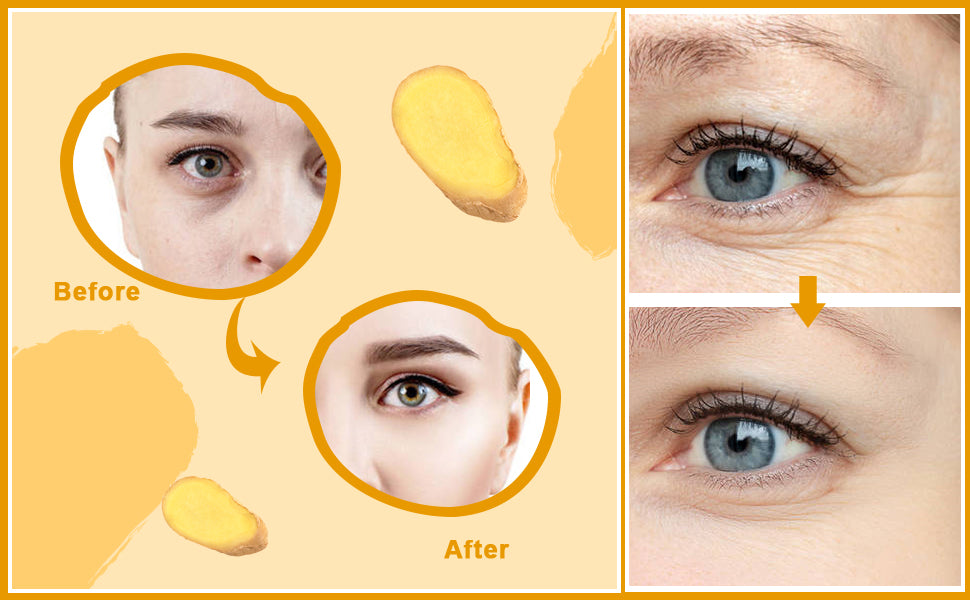 🔥suero corrector de manchas oscuras🥰🔥🔥