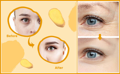 🔥suero corrector de manchas oscuras🥰🔥🔥