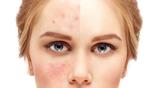 👉🤩BASE PHOERA MATTE ALTA COBERTURA💫🔥